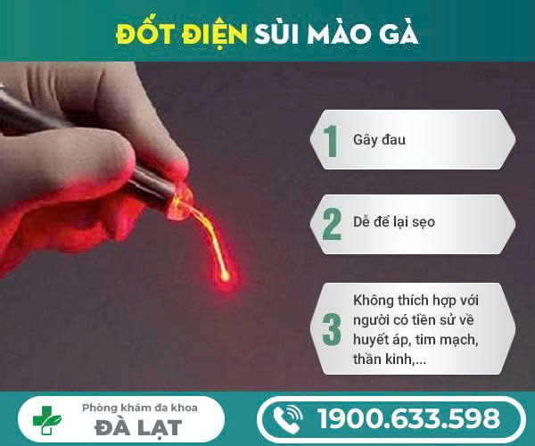 Hình ảnh minh họa